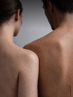 Una mujer y un hombre están de espaldas, ambos sin camisa, y muestran sus hombros y espaldas pecosos frente a un fondo neutro.