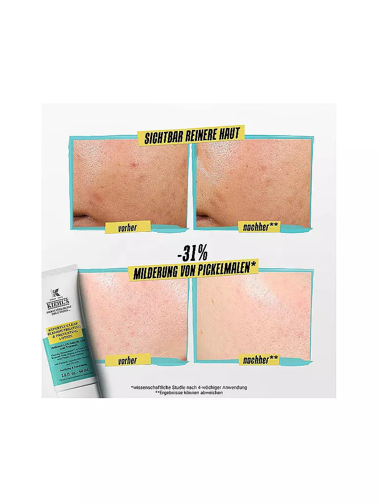 KIEHL'S | Crema facial - Loción para tratar y prevenir imperfecciones Expertly Clear 60ml | 