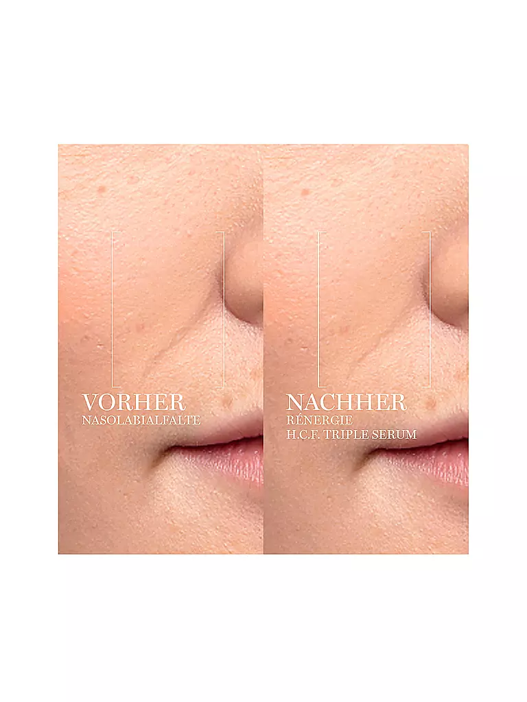 LANCÔME | Rénergie H.C.F. Triple Serum 20ml | Sin color